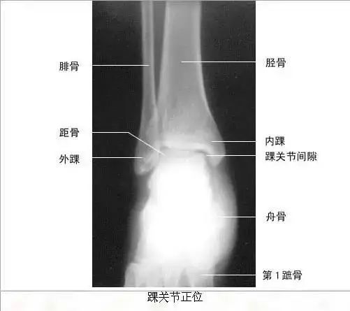 足正常x线解剖图解,常规x线影像解剖图怎么看