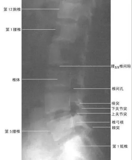 足正常x线解剖图解,常规x线影像解剖图怎么看