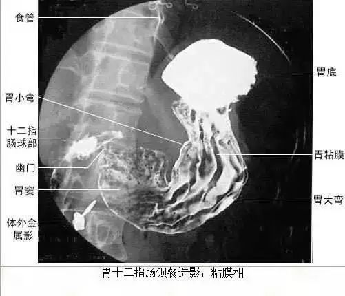 足正常x线解剖图解,常规x线影像解剖图怎么看