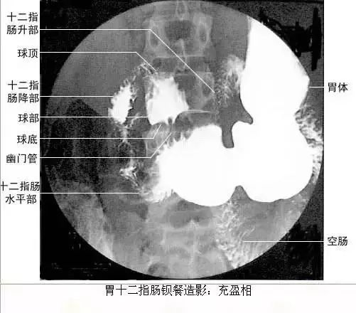 足正常x线解剖图解,常规x线影像解剖图怎么看
