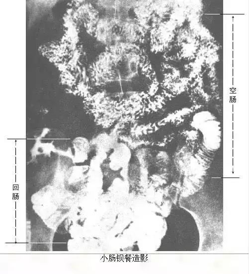 足正常x线解剖图解,常规x线影像解剖图怎么看