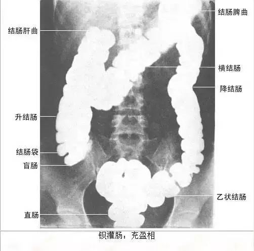 足正常x线解剖图解,常规x线影像解剖图怎么看