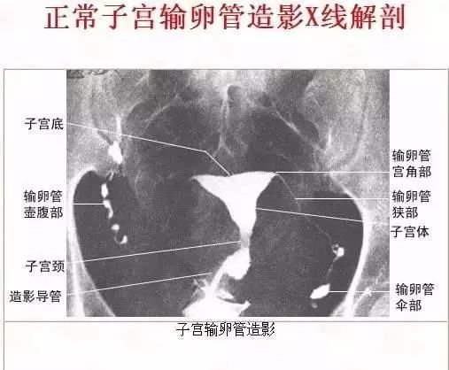 足正常x线解剖图解,常规x线影像解剖图怎么看