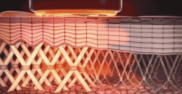 脸上有了皱纹抗老,抗皱要趁早等皱纹出来就晚了