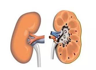 关于肾囊肿发病原因及治疗,请问一下肾囊肿怎么引起的