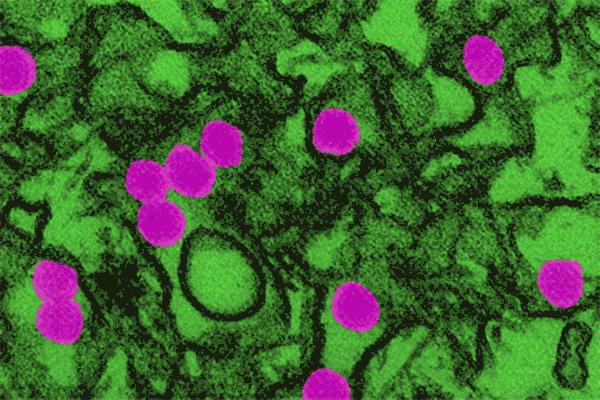 最新新冠病毒怎样消毒,专家介绍防范新冠病毒感染措施