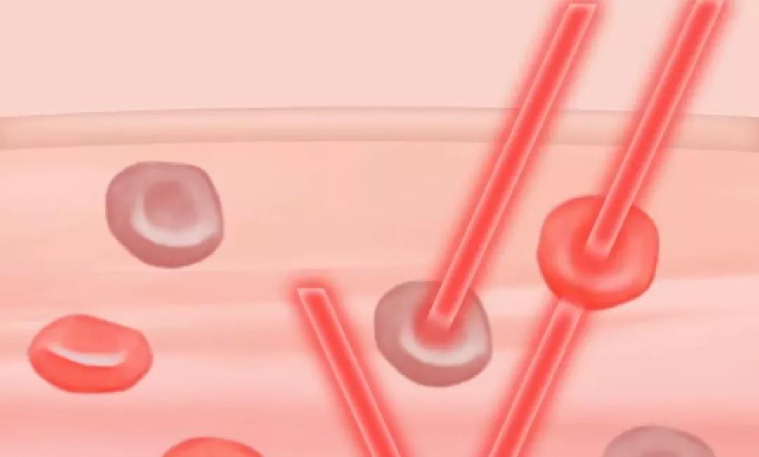 运动手表测血氧测评,运动手表怎么看血氧