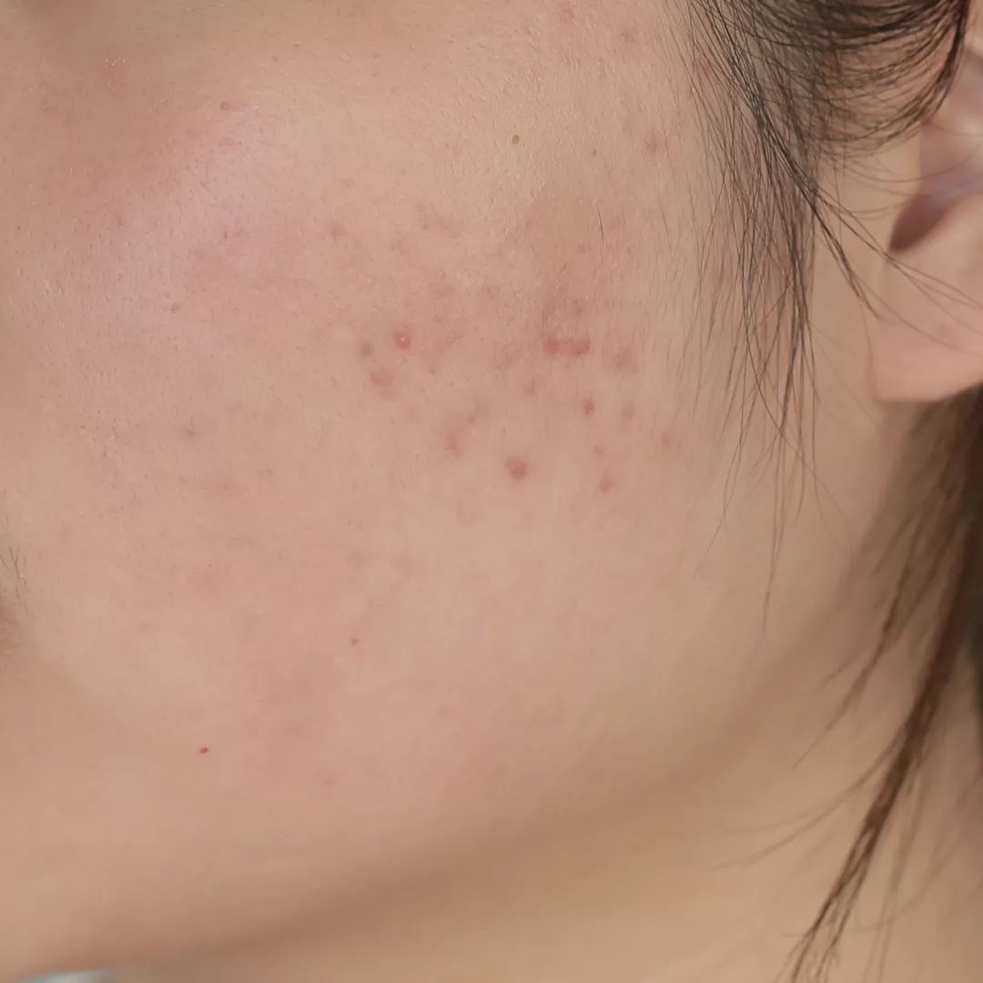 平价气垫遮瑕持久排行榜前十名,8款热门平价遮瑕测评瑕疵皮救星