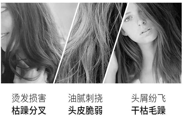 头上的螨虫用什么方法消除,头上又油又痒