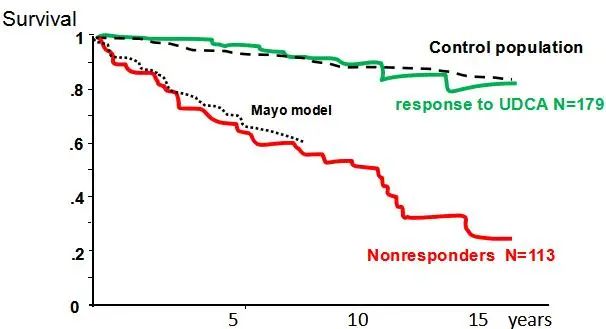 APASL2020|贾继东教授：熊去氧胆酸难治性PBC患者的管理