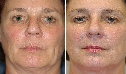 不整容不医美人真的会变吗,不整容的自然美人才是真正的美女