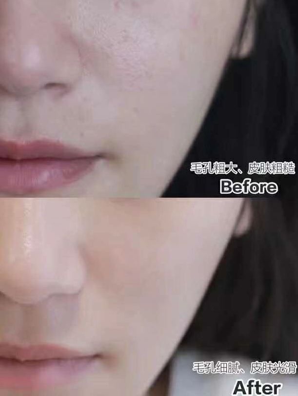 不整容不医美人真的会变吗,不整容的自然美人才是真正的美女