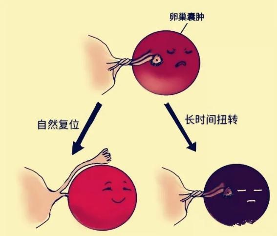 12周的孕妈肚子侧边疼,二胎孕妈37周肚子隐隐疼