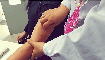 网球肘疼痛难忍别慌试试这个方法,网球肘痛用针刺激穴位可以吗