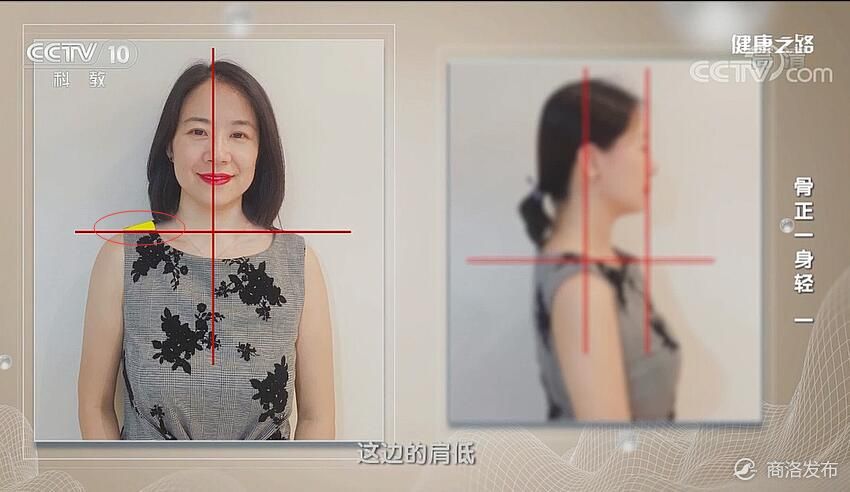 头晕是怎么回事不能左右晃,头晕是什么原因头也不疼也不舒服