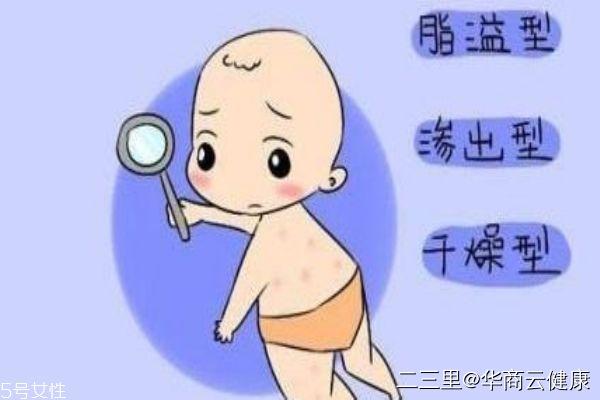 湿疹护理方法,如何护理宝宝湿疹的方法视频