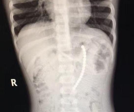 鐩樼偣閭ｄ簺鍧戠埞鐜╁叿,涔扮帺鍏峰墠涔扮帺鍏峰悗