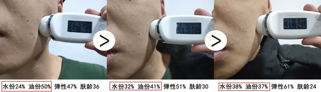 珊苏丽祛痘洁面皂,姗苏丽果酸洁面皂