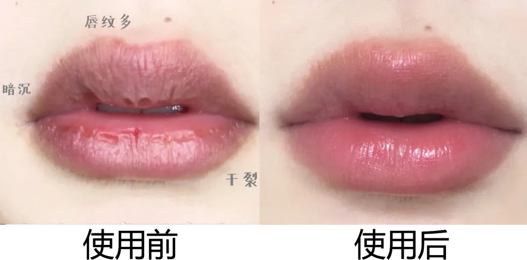 拒绝皮肤干裂带来的尴尬,唇部保养tips教程