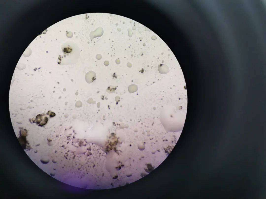 油焖笋为什么会有白点,油焖笋中有白色物质