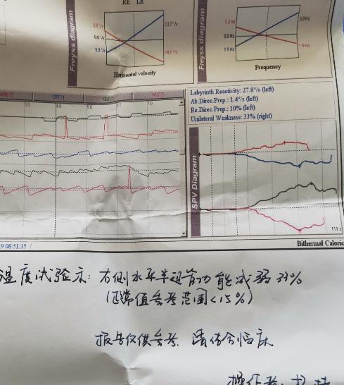 复发性前庭病如何治疗,双侧前庭病治疗