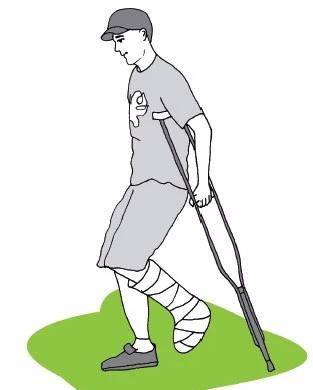 骨折护理四大误区需警惕,骨折愈合过程中的四大误区