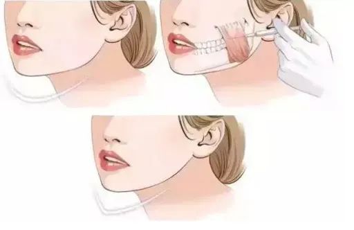 听说戴着口罩，集美们都偷偷在DO脸？