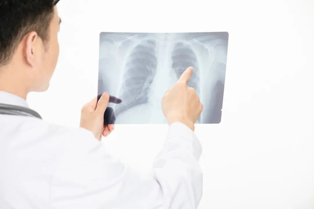 做了ct肺部正常是不是没得新冠,新冠做ct没问题但就是胸闷气短