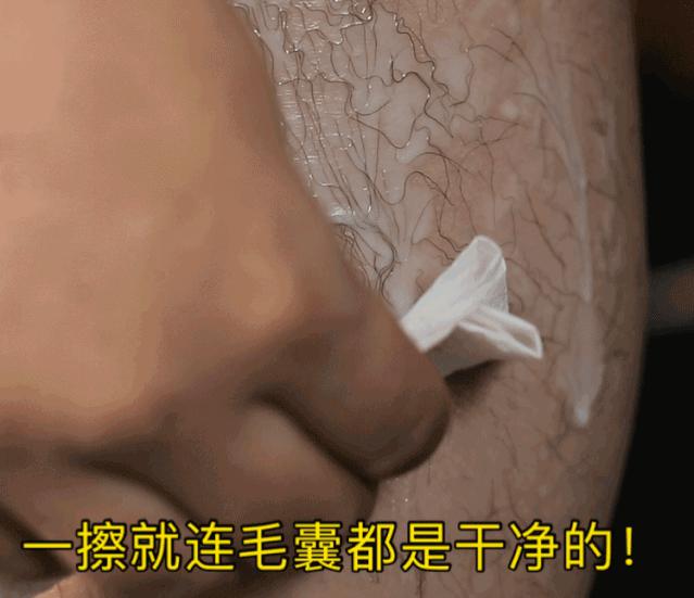 夏季脱毛用它，10分钟肌肤光滑细腻，白2度