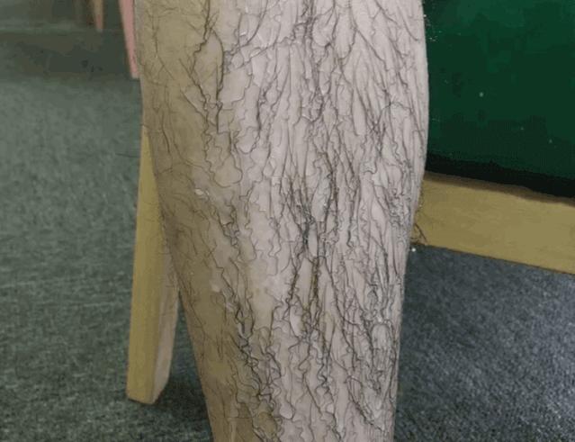 夏季脱毛用它，10分钟肌肤光滑细腻，白2度