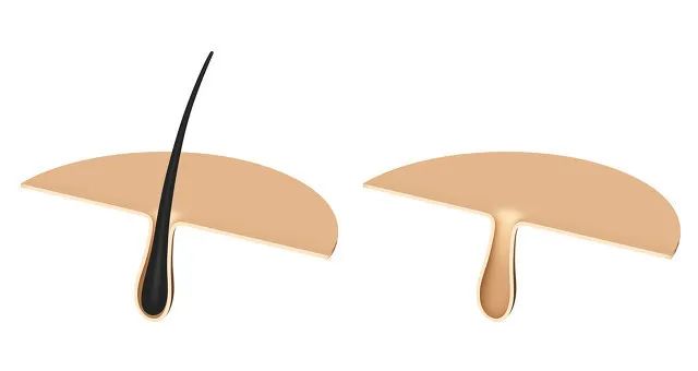 想当人间水蜜桃？人家才没你那么多毛