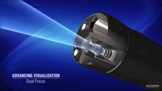 盘点医院各大科室侵入性检查：穿刺、内镜各显神通，小活检标本以“小”见“大”