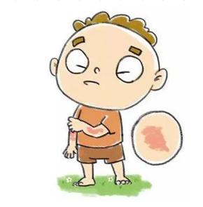 小孩子皮肤红肿瘙痒怎么回事,最近小孩皮肤过敏大面积红肿痒