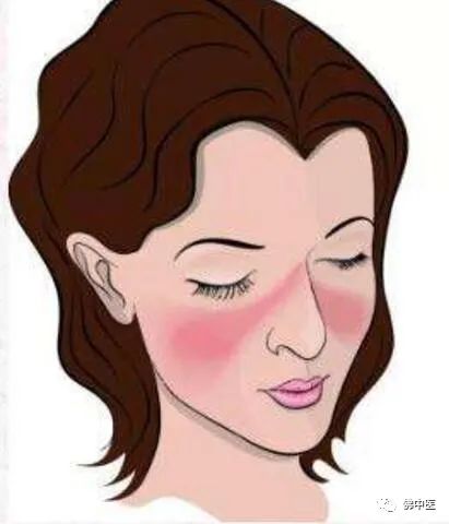 膝关节皮肤突然红肿怎么回事,关节肿痛面部红斑有什么伴随症状