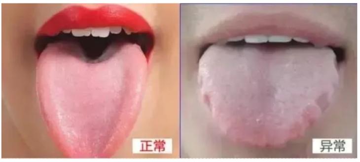 湿气不走，又胖又丑！睡前一贴，逼走体内20多年的湿寒，轻松甩掉失眠、大肚腩