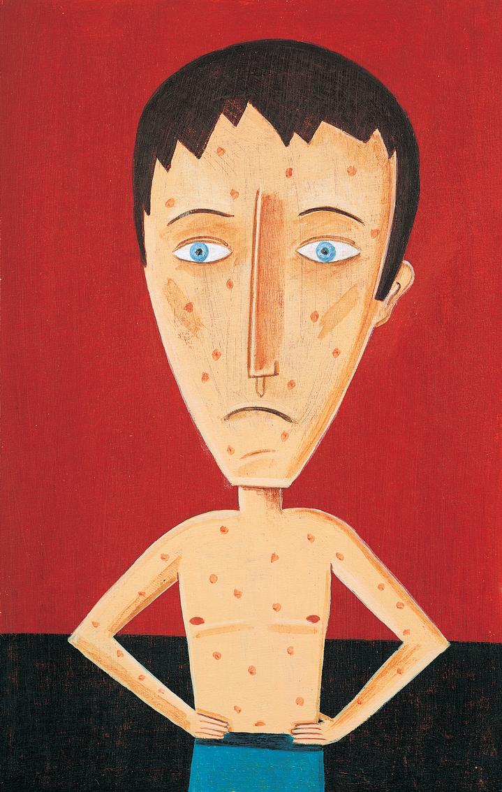 儿子脚臭脚痒,儿子被爸爸脚真菌感染