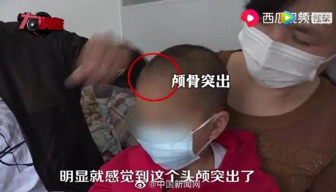 特医奶粉固体饮料事件,固体饮料怎么生产的