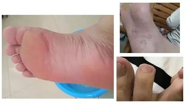 一双能按摩的浴室拖鞋，Q软防滑，好穿到爆，每一步都在保健