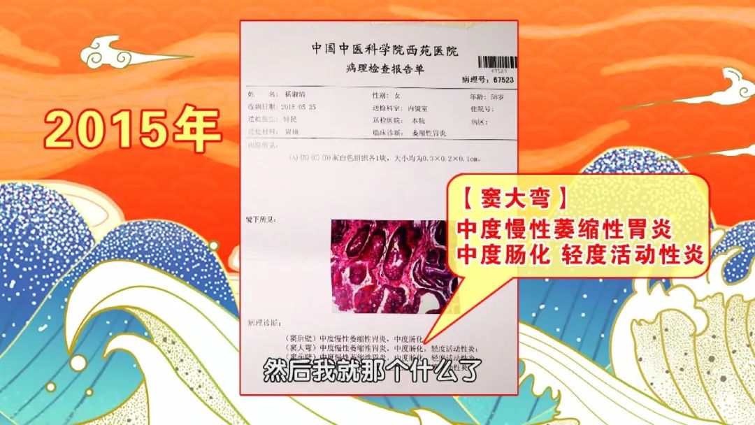 「养生堂」今日17:35播出《万病回春》里的治胃良方