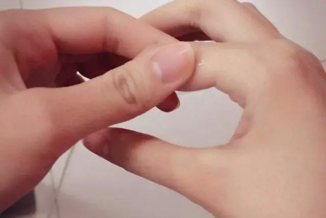 关注｜手上长水泡瘙痒难消？医生提醒：这症状夏天高发