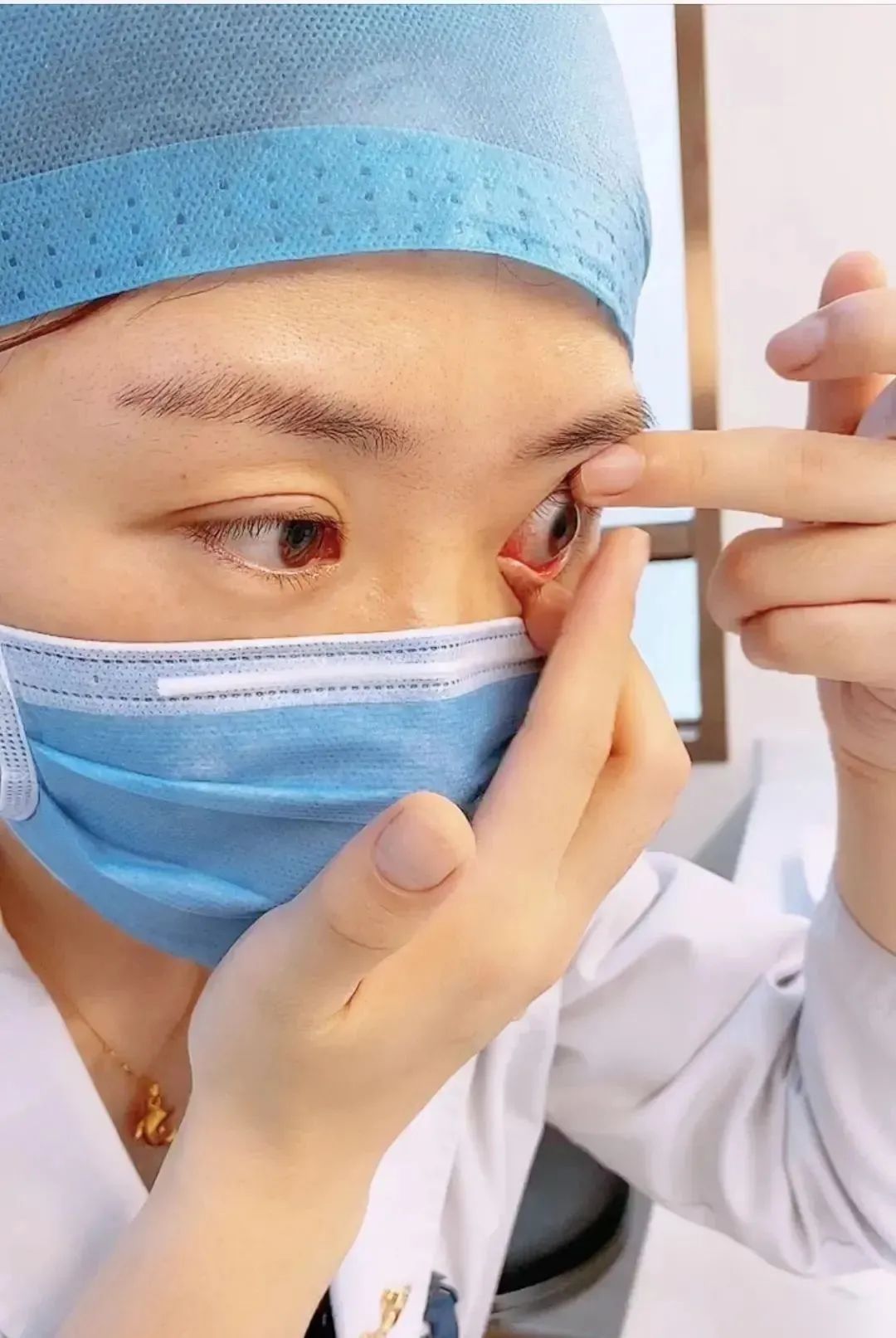 摘隐形眼镜有什么好方法吗,眼科怎么取隐形眼镜
