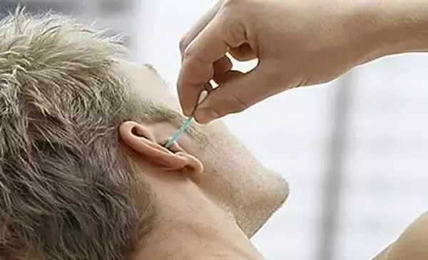 棉签抠耳朵导致癫痫,用棉签掏耳朵不谨慎被撞了一下