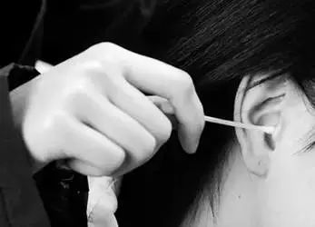 棉签抠耳朵导致癫痫,用棉签掏耳朵不谨慎被撞了一下