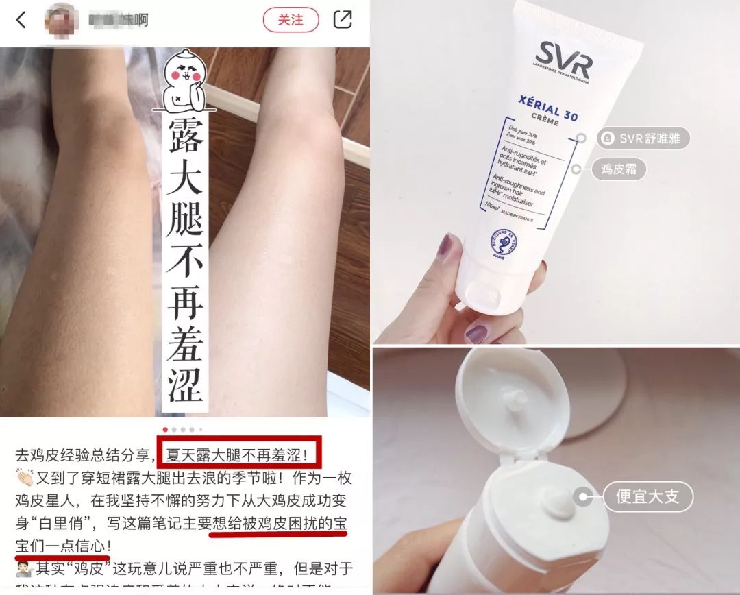 别放弃，烦人的“鸡皮疙瘩”，真的还可以再救一下