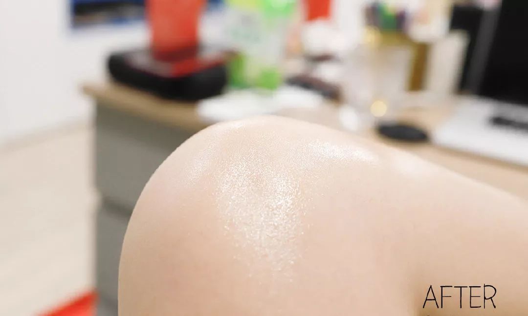 别放弃，烦人的“鸡皮疙瘩”，真的还可以再救一下