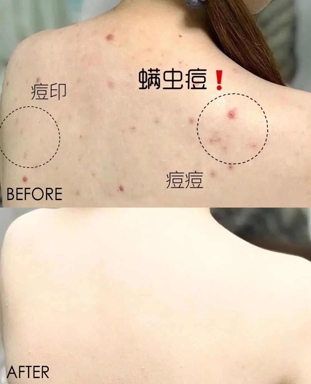 法国Lérane草本净螨贴，萃取天然植物，除螨更安心