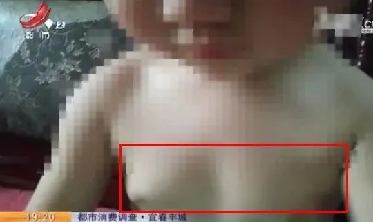 一侧乳房发育疼痛是真早熟吗,女宝宝假性乳腺发育是早熟吗