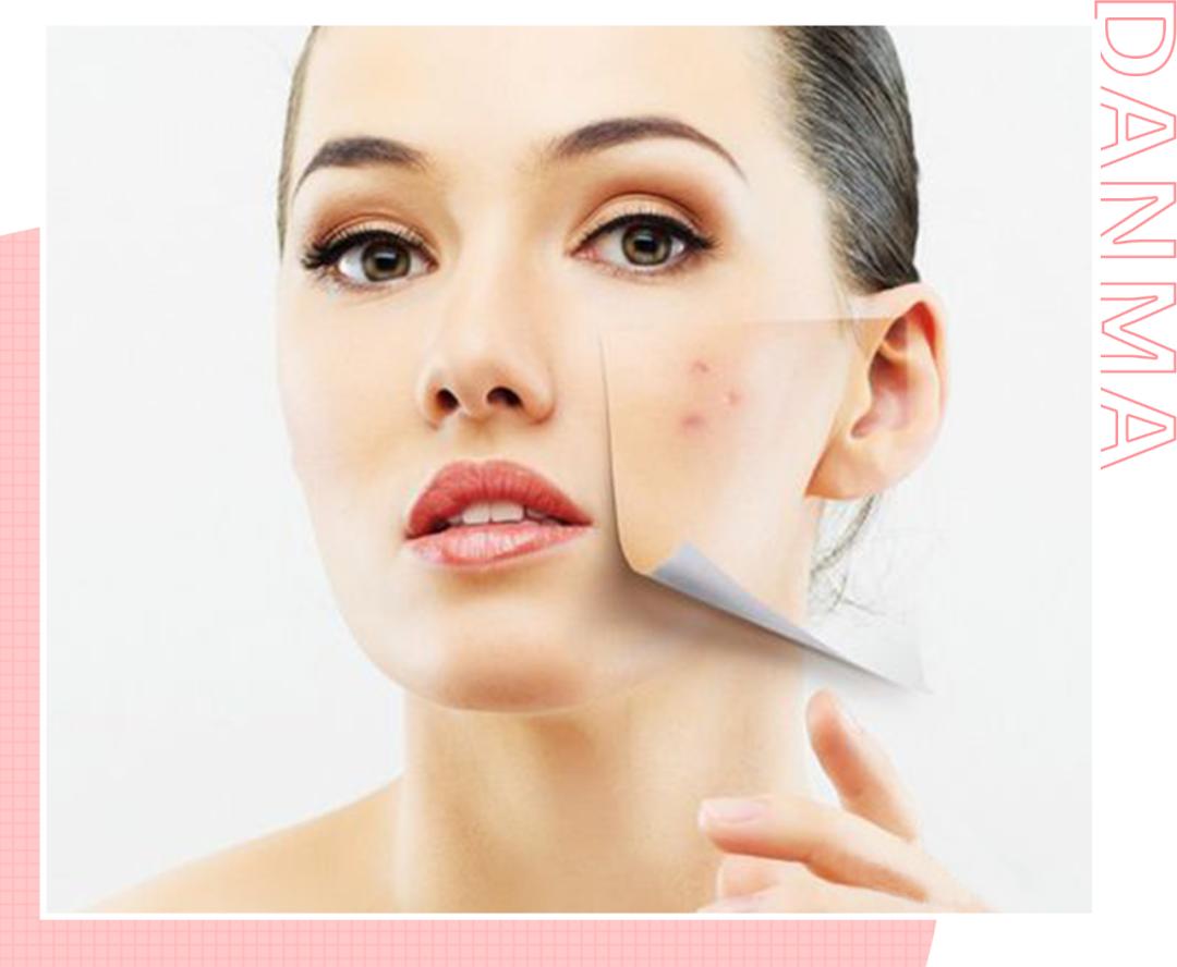 生完孩子皮肤干燥毛孔粗大怎么办,生完孩子后毛孔粗大如何改善