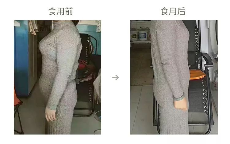 口臭痘痘胃脘疼便秘,痘痘多口臭怎么办