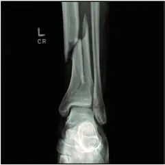 珠江视界|麻醉学科相关最新重要文献导读（2020.06）